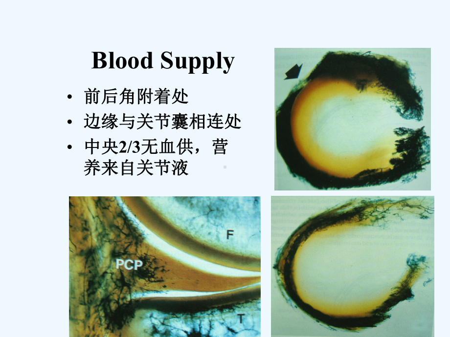 半月板损伤的诊断与治疗幻灯片课件.ppt_第3页