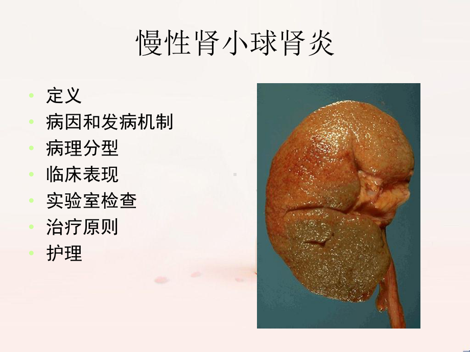 慢性肾小球肾炎的护理课件.ppt_第2页