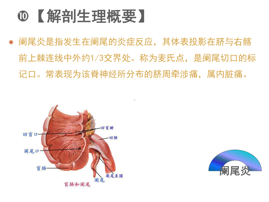 急性阑尾炎患者的护理详解课件.pptx_第2页