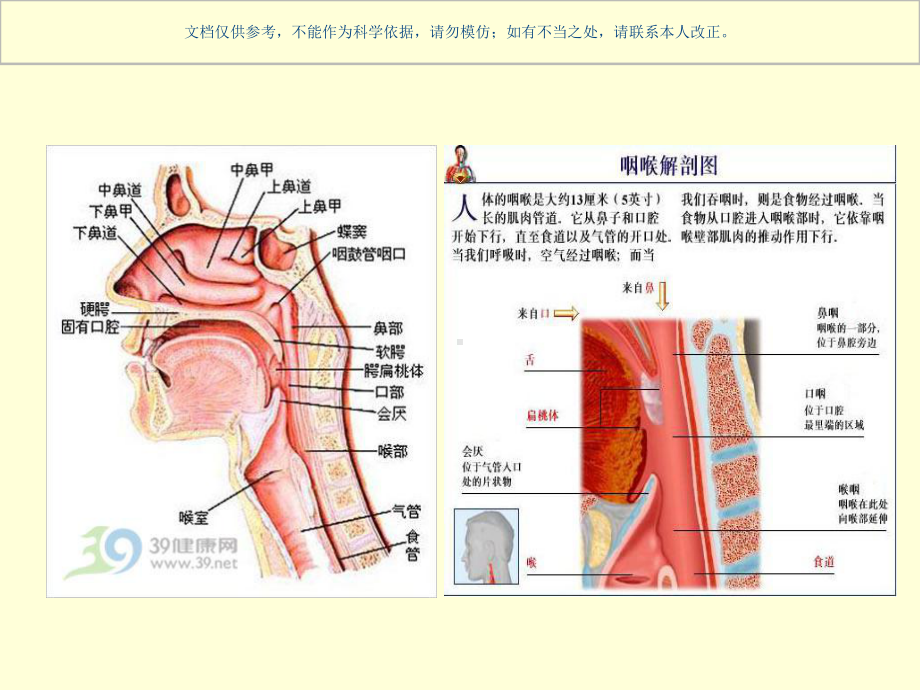 构音障碍和失语症的区别和联系课件.ppt_第2页