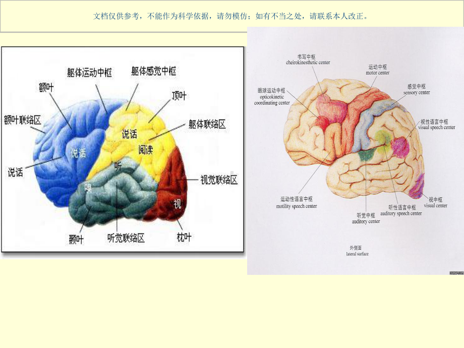 构音障碍和失语症的区别和联系课件.ppt_第3页