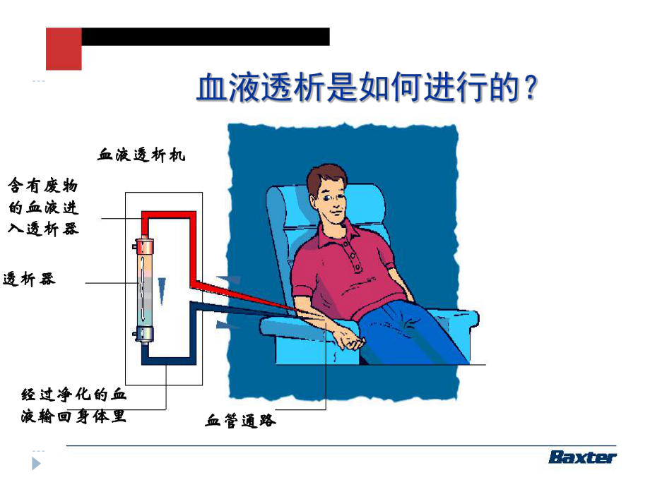 可调钠在血液透析中的应用课件.pptx_第2页