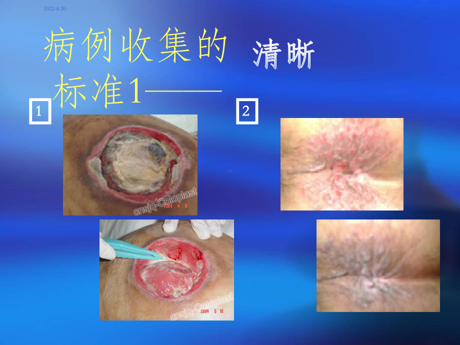 临床病例的收集技巧PPT课件.ppt_第3页