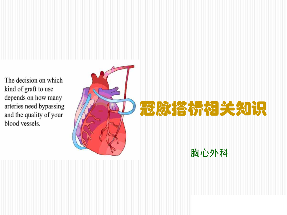 冠脉搭桥手术方式-ppt课件.ppt_第1页