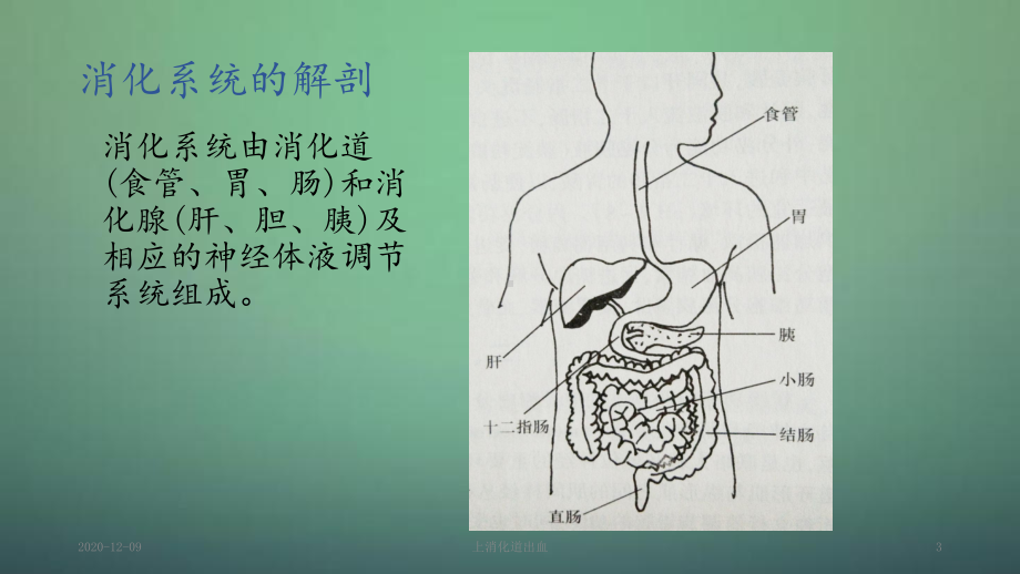 上消化道出血(PPT课件).pptx_第3页