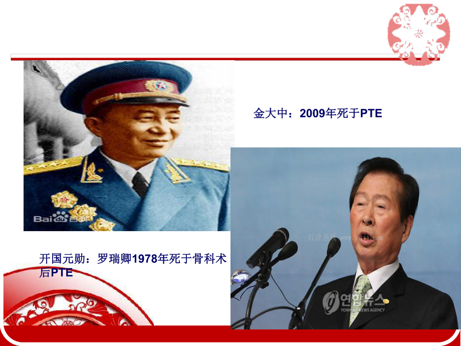 PPT医学课件静脉血栓讲解讲义.ppt_第2页