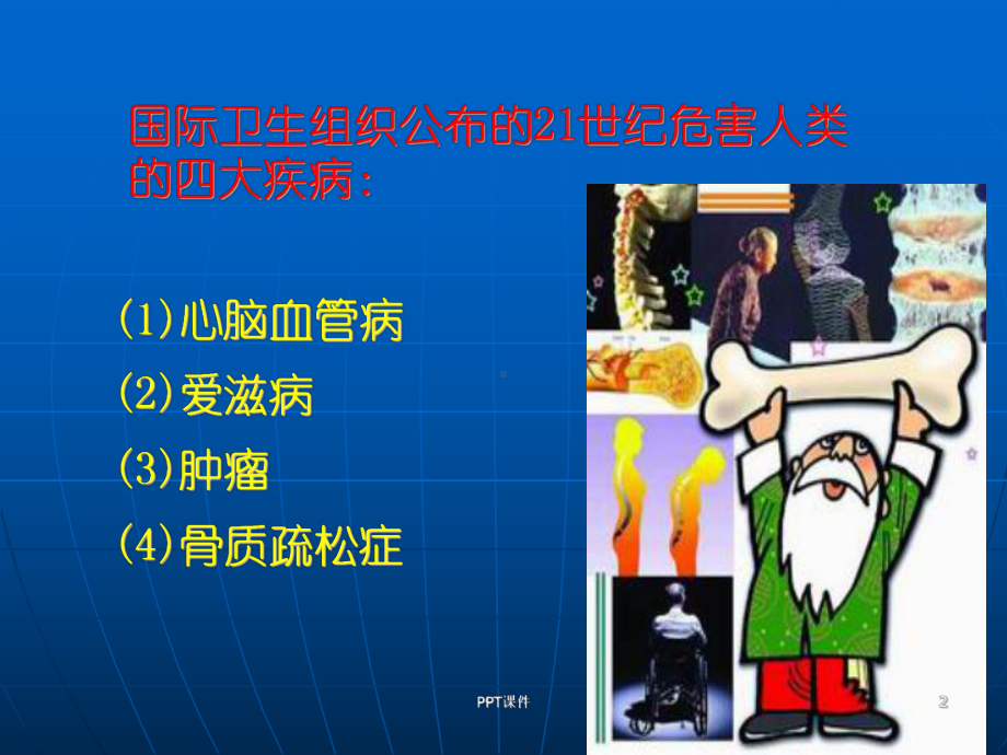 中医药治疗骨质疏松症-ppt课件.ppt_第2页