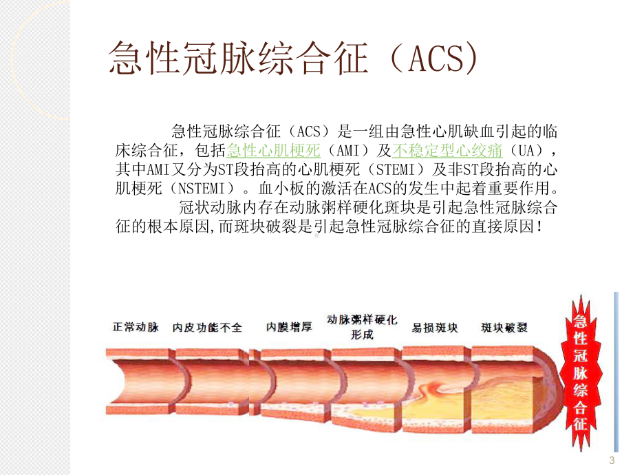 依替巴肽(埃菲替巴肽)浅谈优秀课件.ppt_第3页