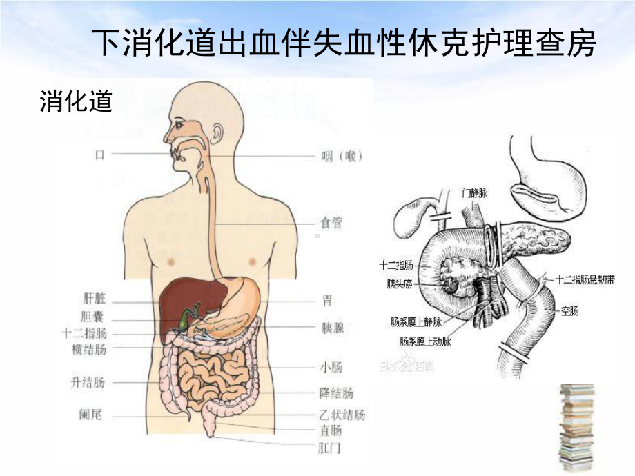 下消化道出血伴失血性休克护理查房-ppt课件.ppt_第3页