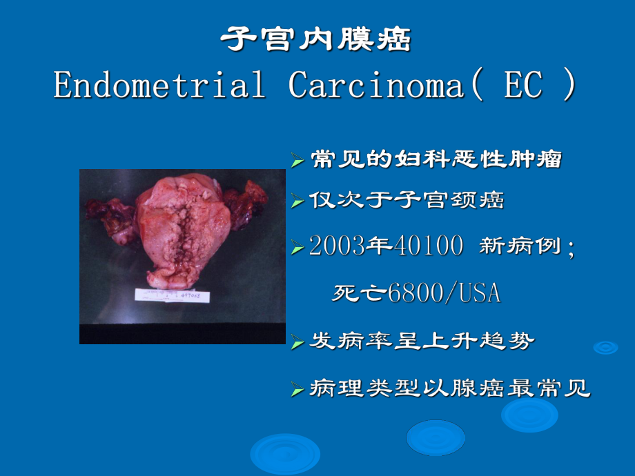 -妇产科子宫内膜癌(教学)ppt课件.ppt_第1页