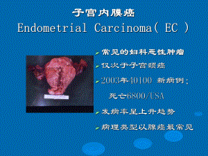 -妇产科子宫内膜癌(教学)ppt课件.ppt