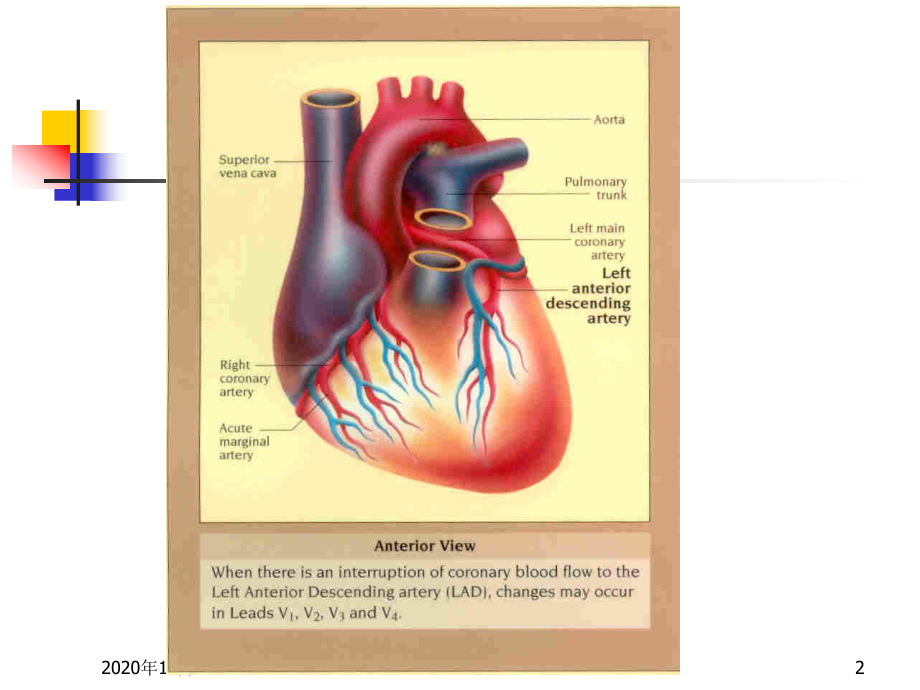 冠心病诊疗进展PPT课件.ppt_第2页