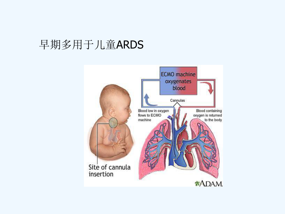 ecmo支持下心脏急危重症救治ppt课件[可修改版ppt].ppt_第3页