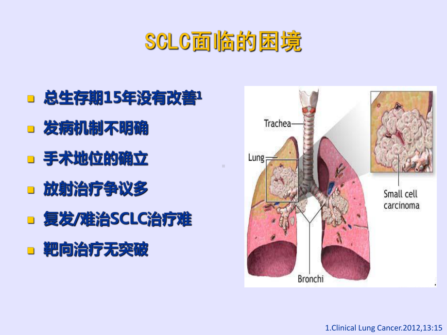 《CSCO小细胞肺癌》PPT课件.ppt_第2页