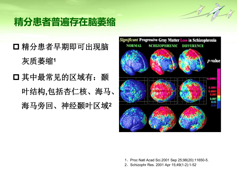 丁螺环酮改善精分患者认知功能-医学课件.ppt_第3页