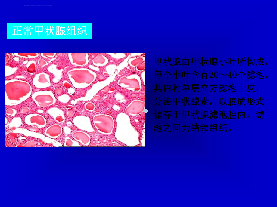 内分泌系统疾病精简版课件.ppt_第3页