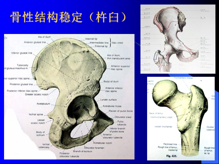 下肢骨关节损伤ppt课件.ppt_第3页