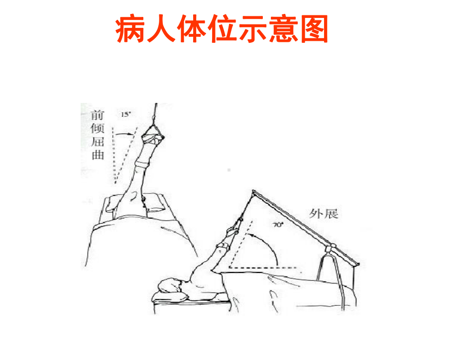 医学课件肩关节镜的简介及肩周炎的鉴别诊断.ppt_第3页