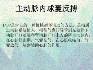 主动脉内球囊反搏及监护CCU课件.ppt