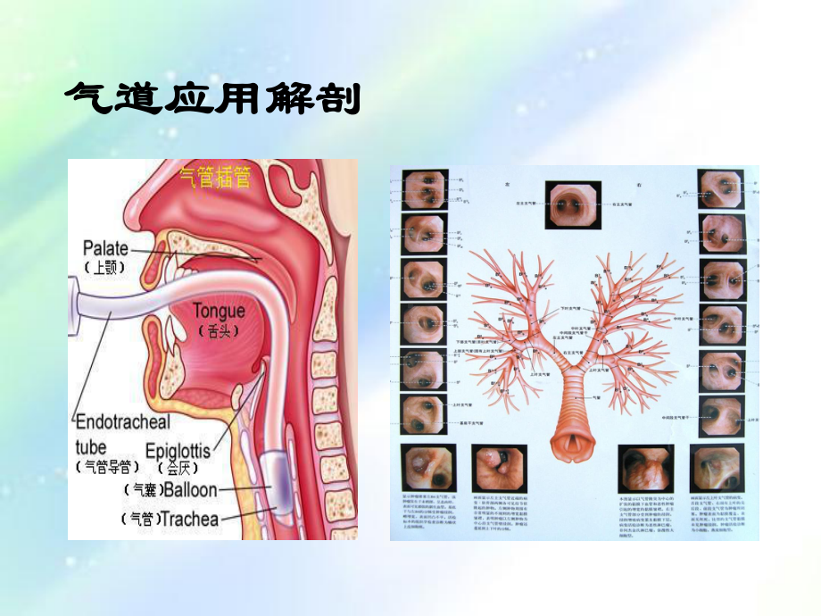 人工气道护理-PPT课件.ppt_第3页