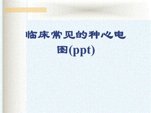 临床常见的种心电图(ppt)课件.ppt