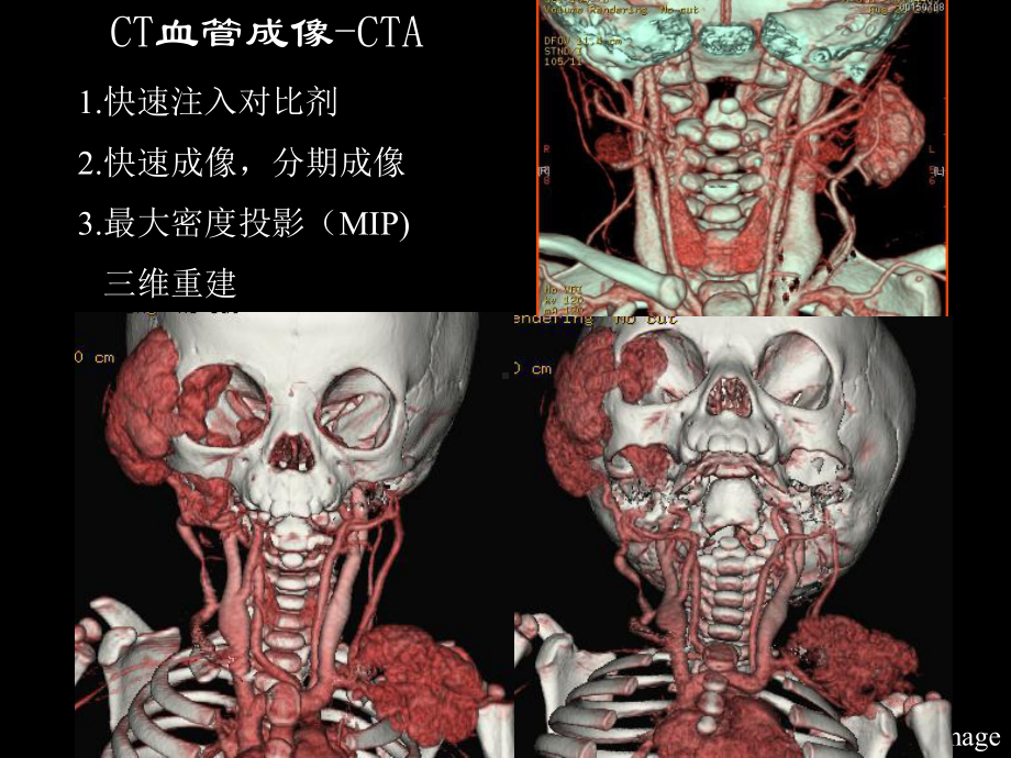 CT-MR在儿科的应用课件.ppt_第3页