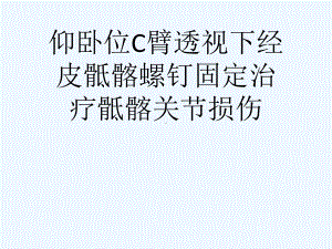 仰卧位C臂透视下经皮骶髂螺钉固定治疗骶髂关节损伤[可修改版ppt]课件.ppt