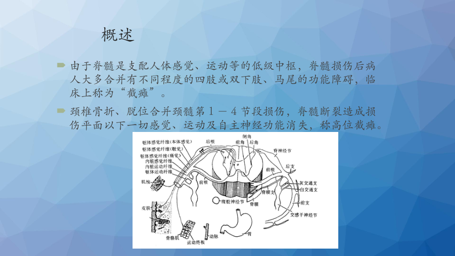 创伤性高位截瘫病人护理-ppt课件.pptx_第3页