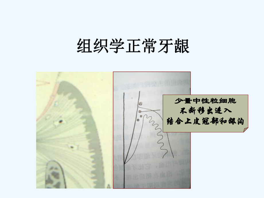 优选牙周病学牙周病的主要症状和临床病理[可修改版ppt]课件.ppt_第3页