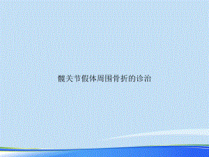 2021年髋关节假体周围骨折的诊治完整版PPT课件.ppt