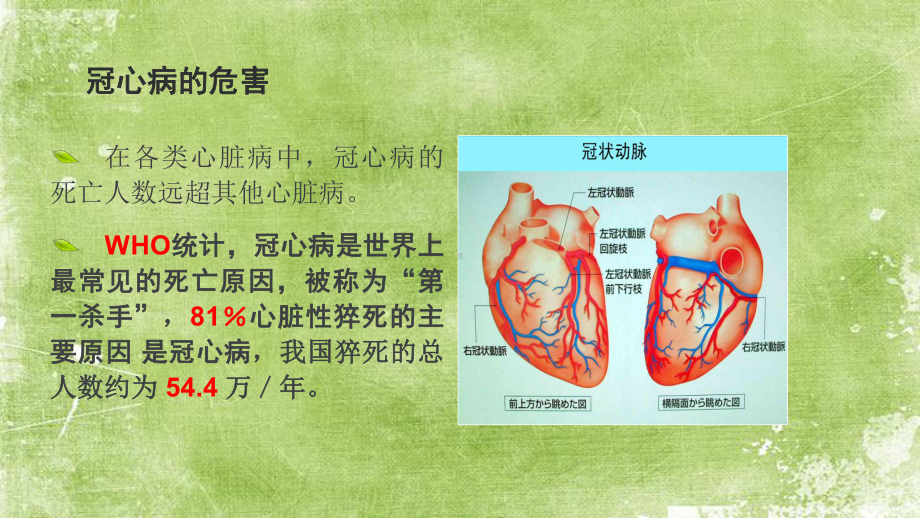 中医药养生保健治疗冠心病-PPT课件.pptx_第2页