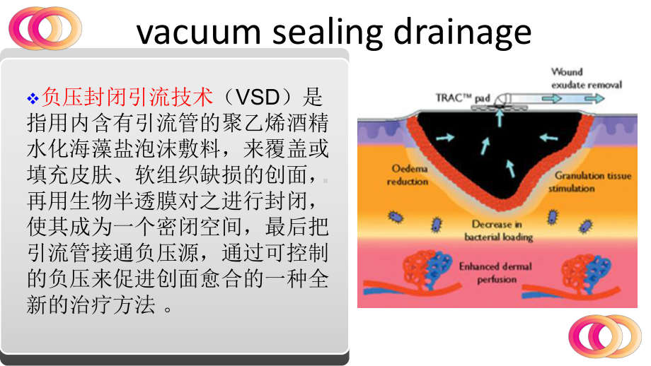 医学课件VSD负压封闭引流技术护理查房.ppt_第1页