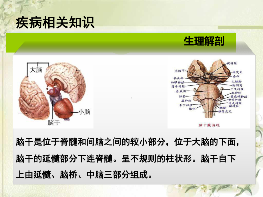 1例重脑干出血并VAP患者的个案护理查房总结课件.pptx_第3页