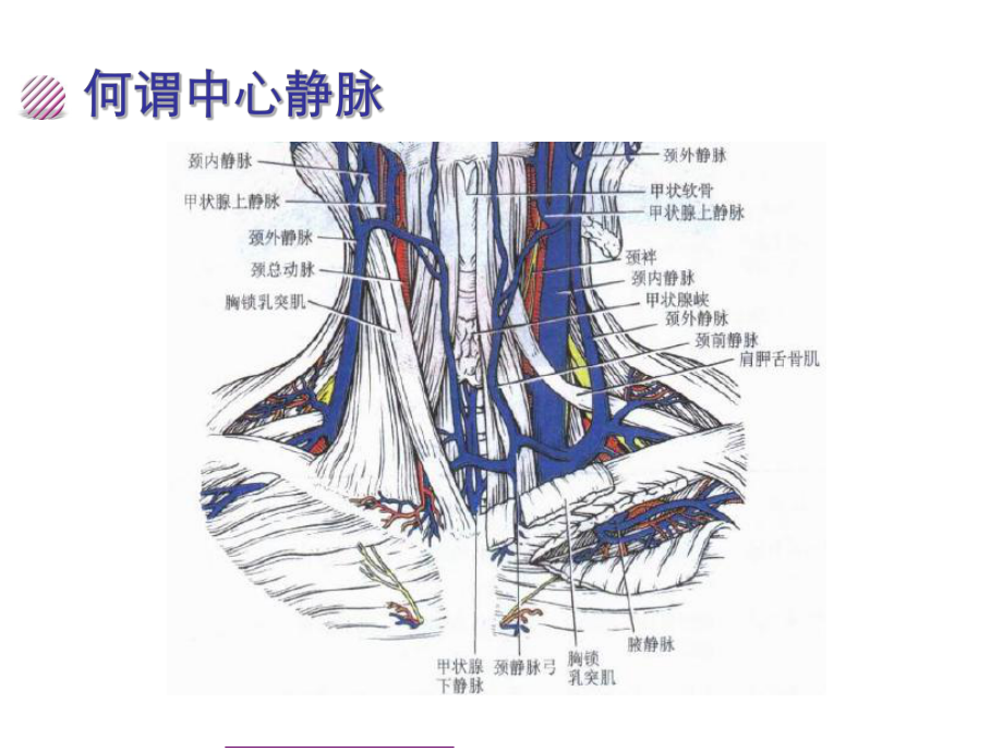 CVC置管与护理查房ppt(完整版)课件.pptx_第2页