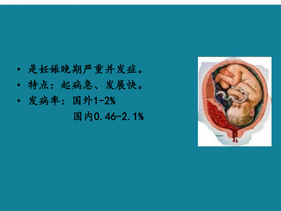 (优选)妇产科学胎盘早剥前置胎盘课件.ppt_第3页