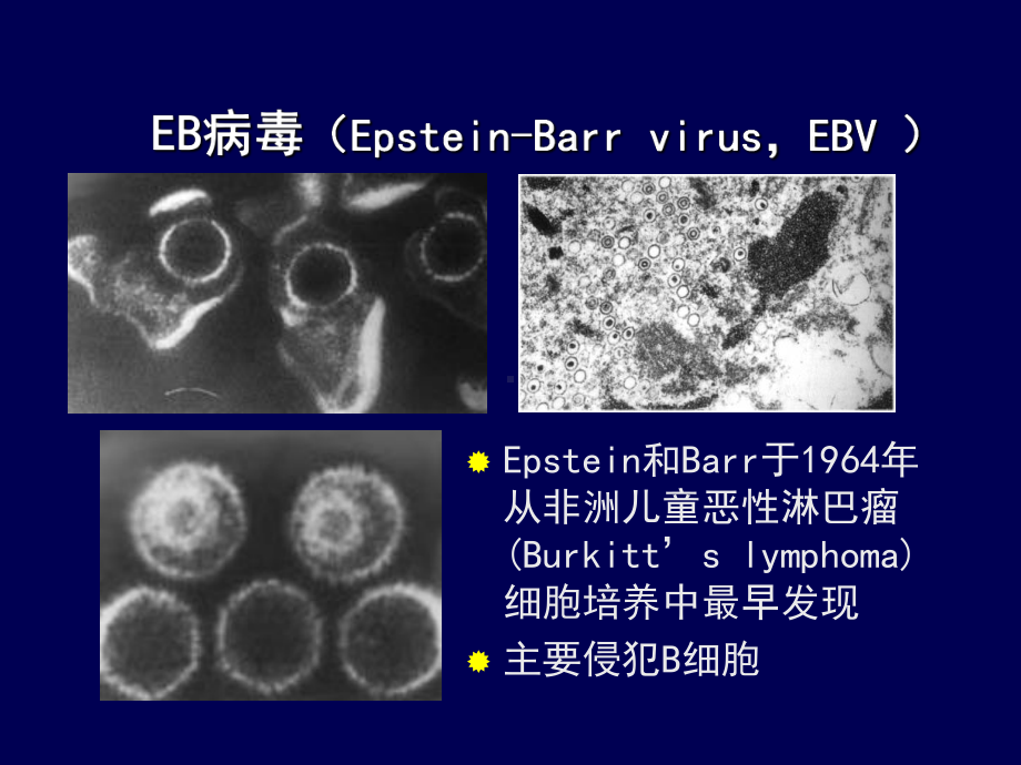 传染性单核细胞课件.ppt_第3页