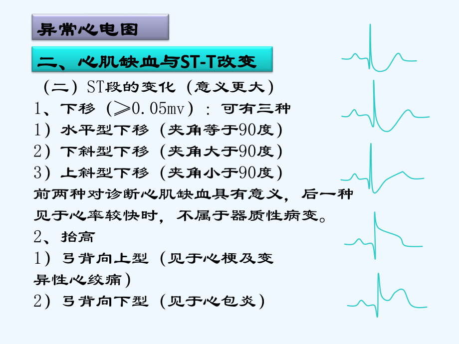 临床常见心电图判读ppt.(ppt)课件.ppt_第3页