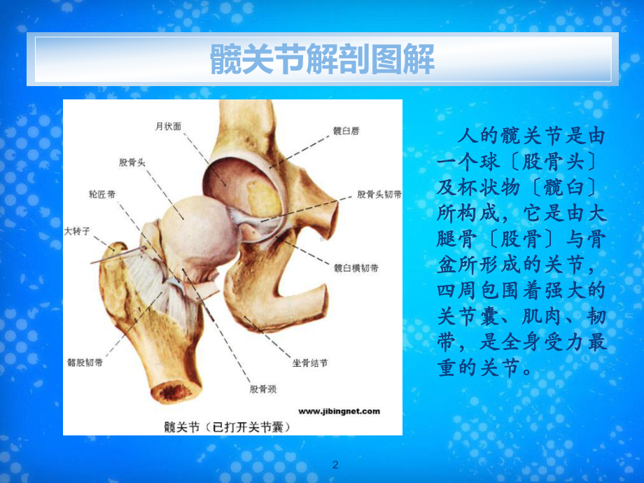 人工髋关节置换术课件.ppt_第2页