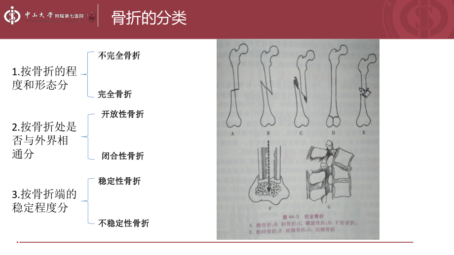 医学课件下肢骨折的护理.ppt_第3页