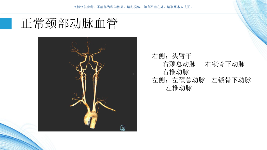 头颈部血管变异课件.ppt_第1页