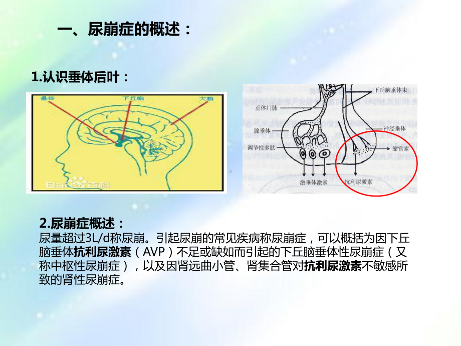 尿崩症护理查房-PPT课件.ppt_第3页