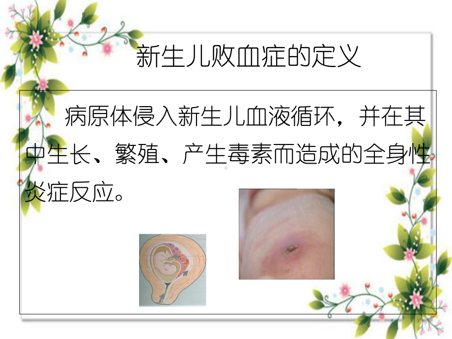 新生儿脓毒血症课件.ppt_第2页