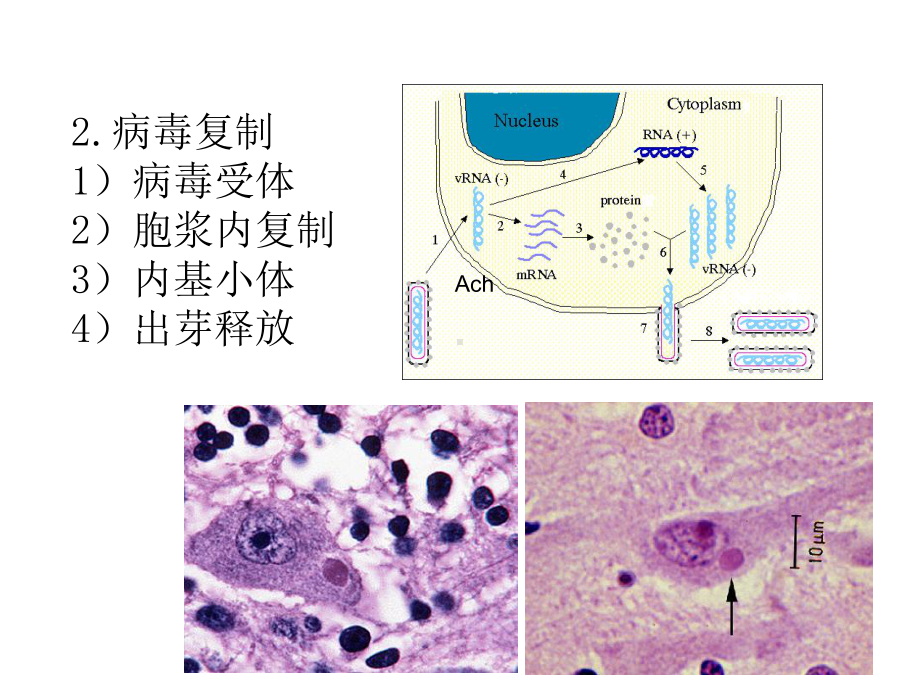 医学狂犬病毒专题知识宣讲课件.ppt_第3页