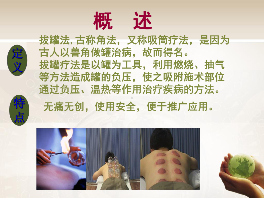 拔罐疗法专业知识讲座讲义课件.ppt_第2页