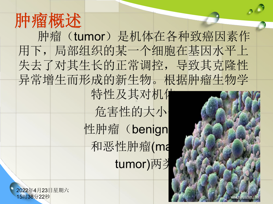 护理心理学—临床各类病人的心理护理三课件.pptx_第3页