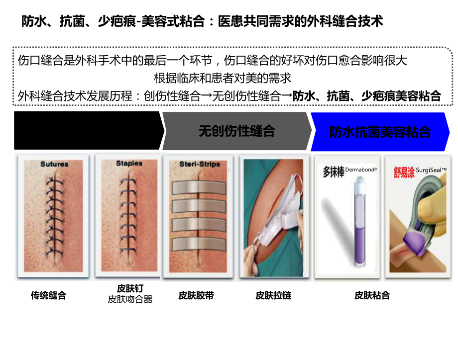 医用粘合剂产品介绍ppt课件.ppt_第2页