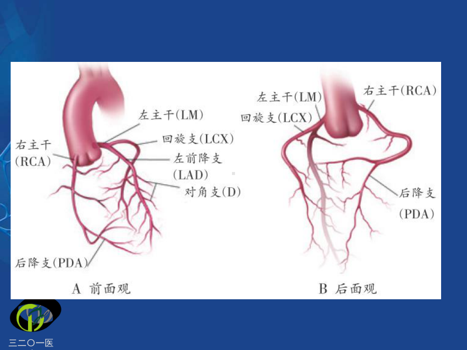 冠状动脉的解剖与冠脉造影55881课件.ppt_第3页