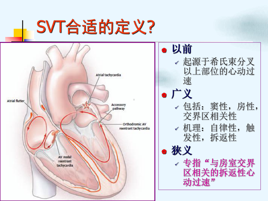 室上性心动过速的识别与处理技巧PPT课件.ppt_第3页