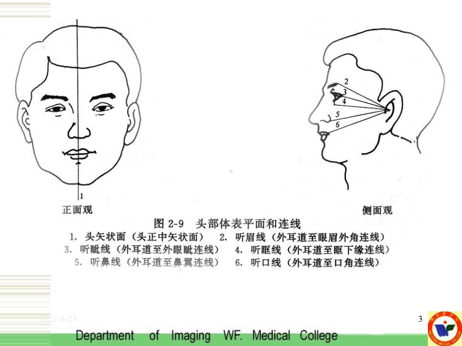 分角线投照技术-口腔颌面外科学课件.ppt_第3页