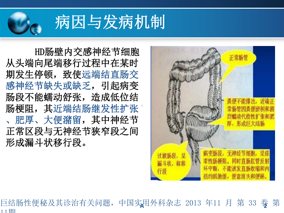 先天性巨结肠-修改课件.ppt_第3页